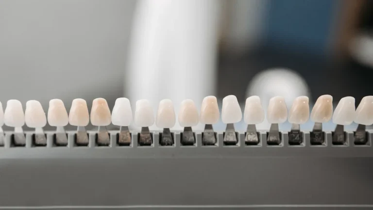 Close-up of dental veneers arranged neatly on a display rack in a dental office setting.