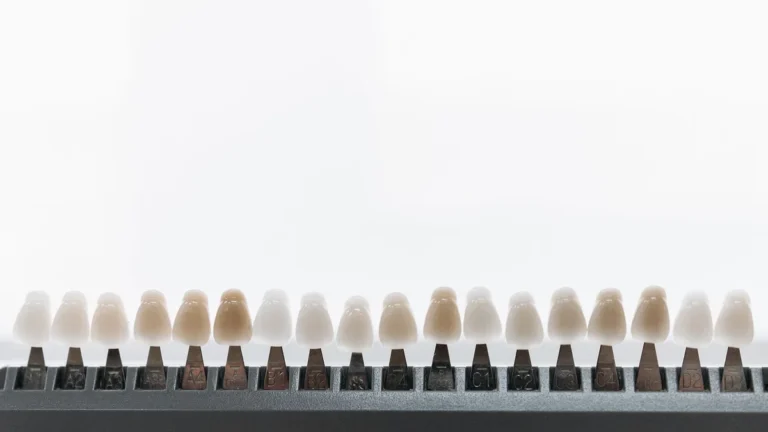 Close-up view of dental veneers on a display rack, showcasing various shades.