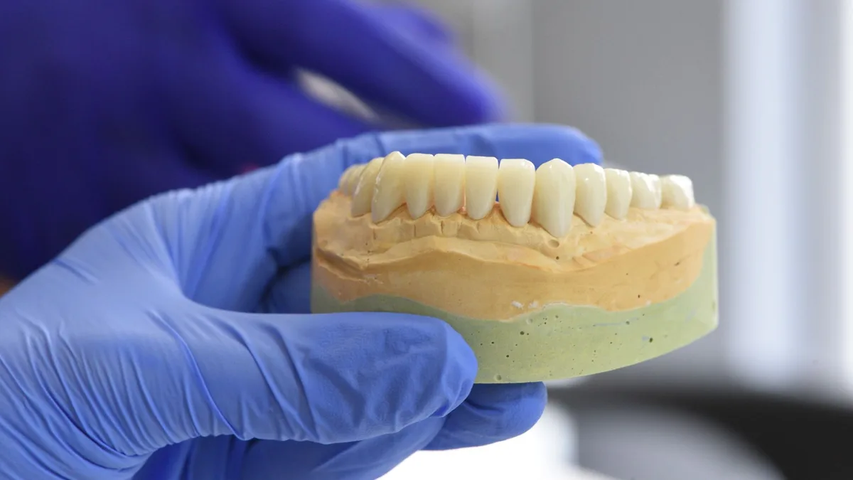 Close-up of a dental model held by gloved hands in a laboratory setting.