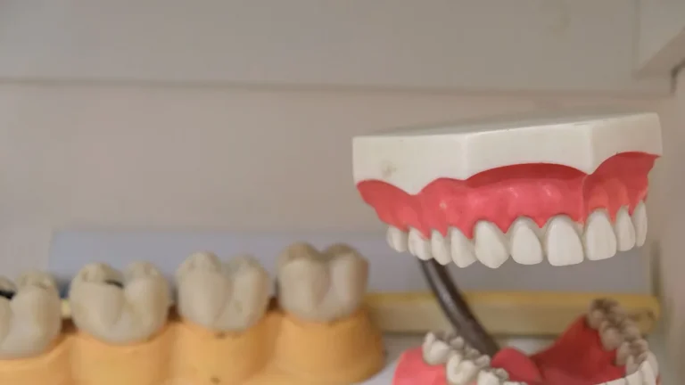 Close-up image showing detailed dental models and dentures on display, ideal for dental education.