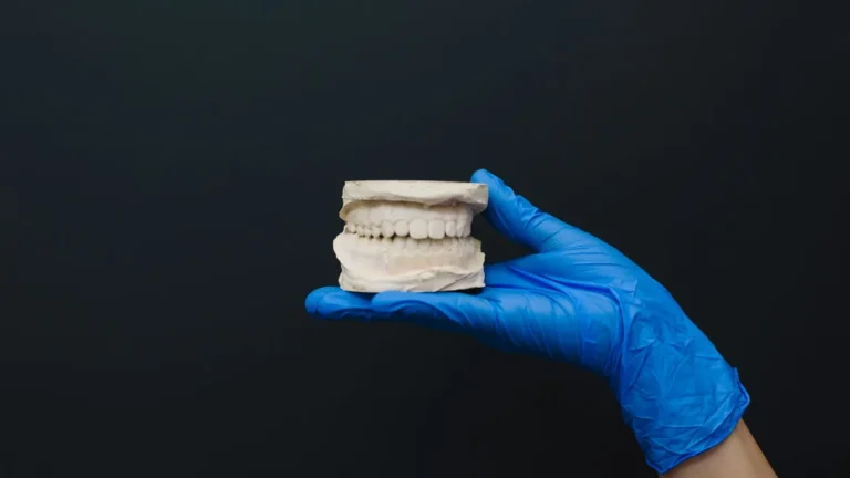 Close-up of latex-gloved hand holding dental model against a dark background.