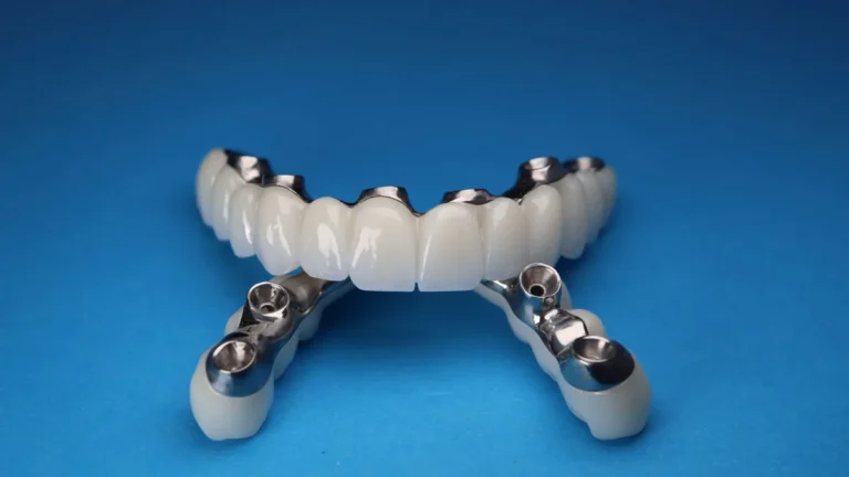 Close-up of dental implant prosthetics on a vivid blue background, showcasing precision and dental technology.