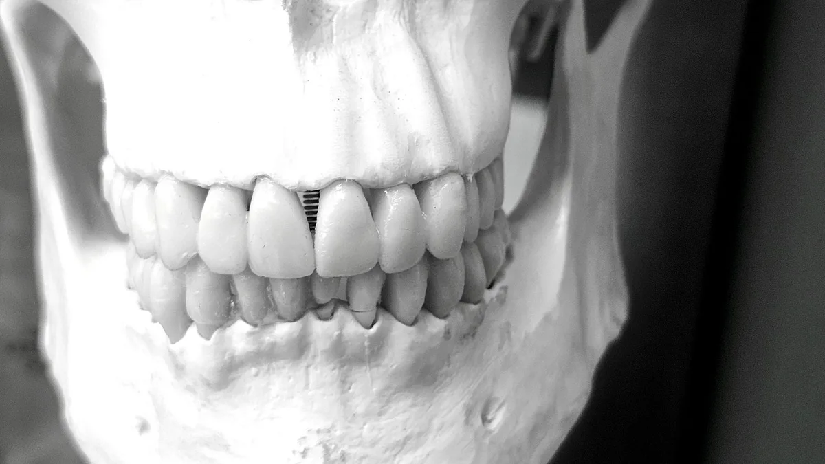 Detailed image of a human skull showcasing dental structure and alignment in a medical context.